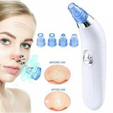 REMOVEDOR DE ACNE FACIAL VACUUMSHOP (FRETE GRÁTIS)